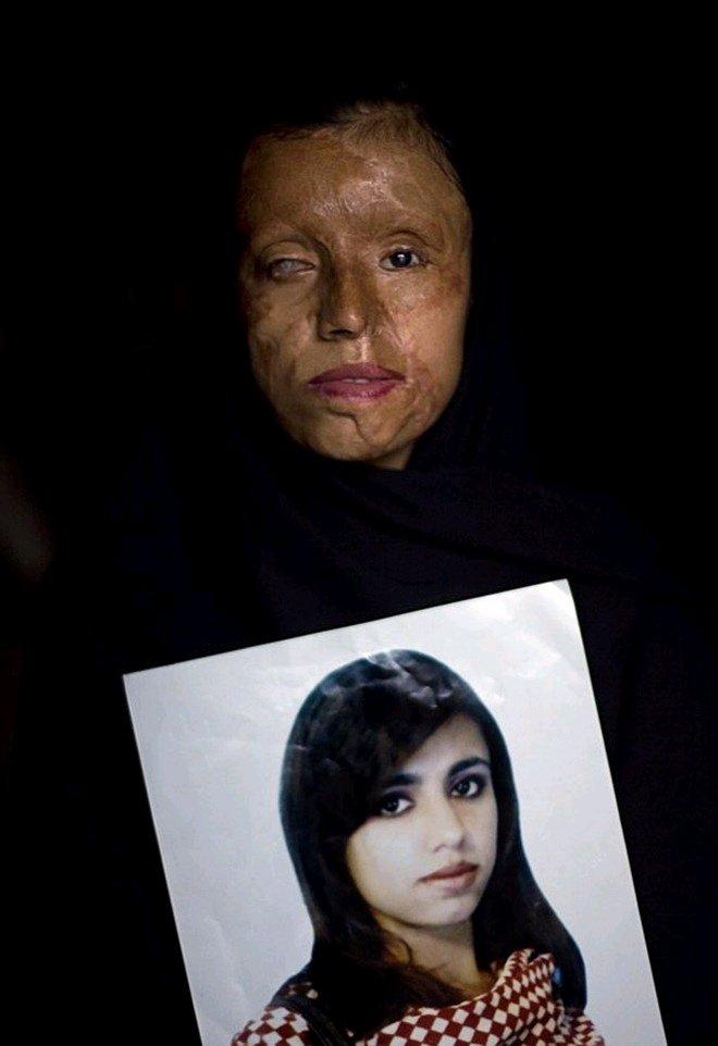 Νεαρές γυναίκες στο Πακιστάν αποκαλύπτουν τις συνέπειες της άρνησης μιας πρότασης γάμου