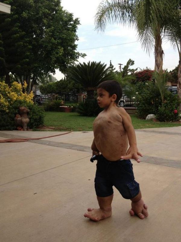 Η συγκινητικη ιστορία ιστορία του μικρού Τζιοβάνι