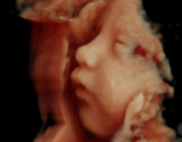 HD-4D: το νέο, ρεαλιστικό υπερηχογράφημα του μωρού σας!Φανταστικες φωτογραφιες και video