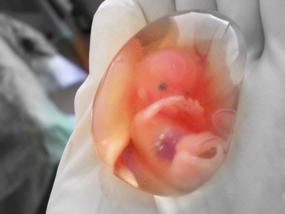 Το παράπονο ενός εμβρύου  Απίστευτο βίντεο...........