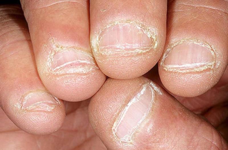 10 συνήθειες στην καθημερινότητά που μας κάνουν κακό και μπορεί να προκαλέσουν προβλήματα στην υγεία μας.