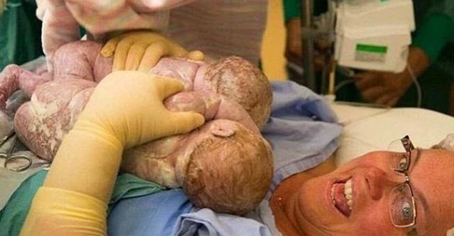 Δείτε τη μαμά  που έβγαλε με τα ίδια της τα χέρια από τη κοιλιά   τα δίδυμα μωρά της κατά τη διάρκεια της καισαρικής τομής! (βίντεο)