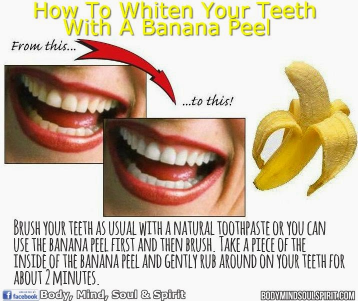Πώς να λευκάνετε τα δόντια σας με μια φλούδα μπανάνας (Βίντεο)