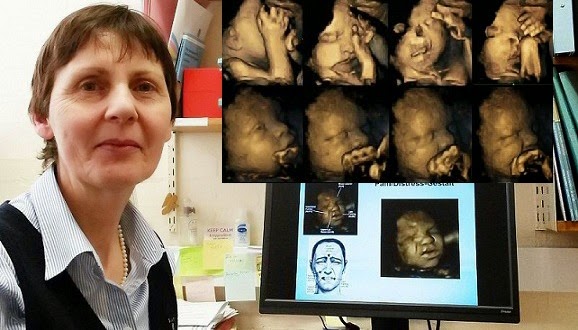 Εικόνες σοκ απο εμβρύα που υποφερουν στην μητρα την ώρα που η μάμά τους καπνίζει.Εικόνες και βίντεο
