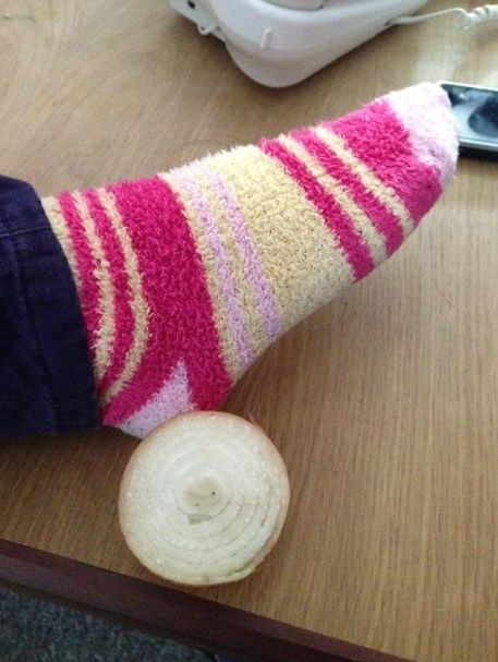 Έτσι, εάν είστε πωλούνται, τώρα τι κάνετε; Το πρώτο πράγμα που πρέπει να κάνετε είναι να κοπεί και να δοθεί κάποια κρεμμύδι στα πόδια σας στις κατάλληλες θέσεις. Μπορείτε να χρησιμοποιήσετε το κόκκινο ή λευκό κρεμμύδια.