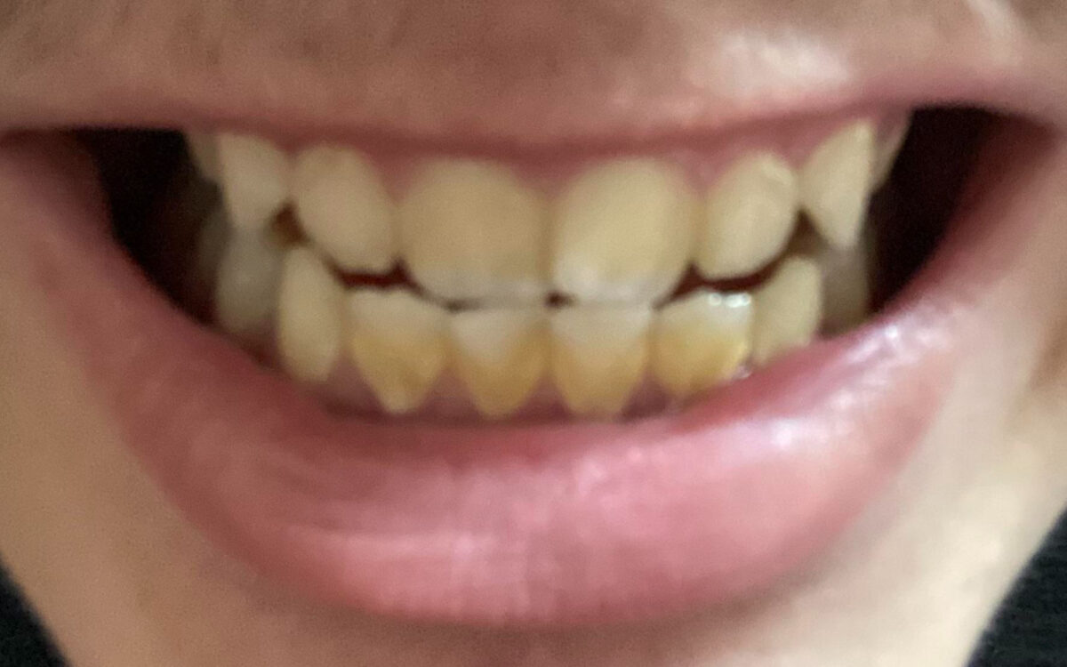 Μυρίζει το στόμα σας ; Δείτε ποιες σοβαρές ασθένειες μπορεί να κρύβει