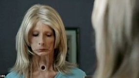 Η συγκλονιστική διαφήμιση που έκανε 100.000 ανθρώπους να κόψουν το κάπνισμα [βίντεο]