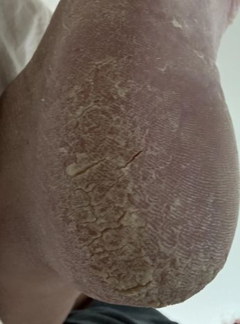 10 απίθανες χρήσεις του baking powder