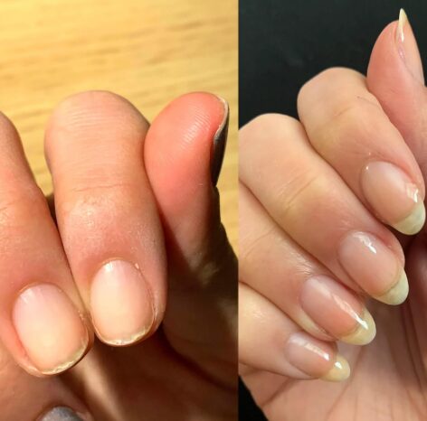 10 απίθανες χρήσεις του baking powder