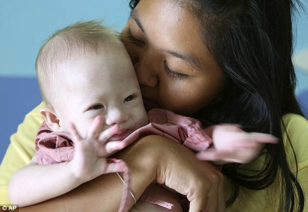 Εγκατέλειψαν το μωρό τους στην παρένθετη μητέρα γιατί γεννήθηκε με σύνδρομο Down
