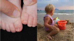 Τα 4 επικίνδυνα μικρόβια που κρύβονται στην άμμο και τις πισίνες