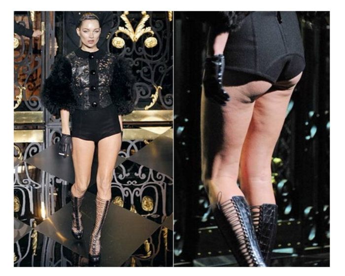 40 διάσημες celebrities χωρίς ρετούς, με φουλ κυτταρίτιδα! 40 διάσημες celebrities χωρίς ρετούς, με φουλ κυτταρίτιδα!