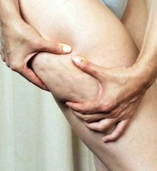 κυτταριτιδα