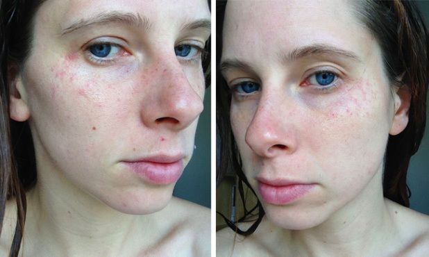 dite-giati-den-prepi-na-kimaste-vammenes4_