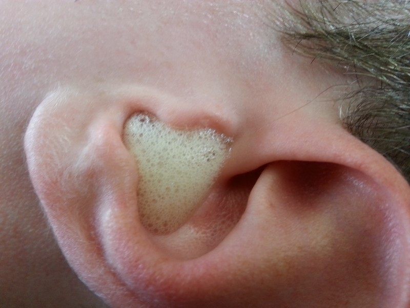 Δείτε πως μπορείτε να καθαρίσετε τα αυτιά σας χωρίς μπατονέτες
