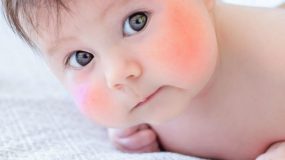 Τι μπορεί να σημαίνουν τα «κόκκινα μάγουλα» στο μωρό μας