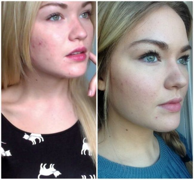 Σπιτικά κόλπα ομορφιάς για τις γιορτές. Για να λάμπεις Χριστούγεννα και τη Πρωτοχρονιά.