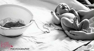 Απίστευτες φωτογραφίες με μωρά συνδεδεμένα με τον εμφάλιο λώρο που θα σας κόψουν την ανάσα! 7 mora-prin-kopsoun-to-emfalio-loro7_