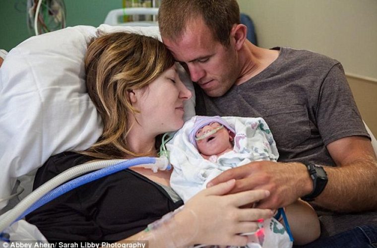 Μητέρα με τεράστια ψυχικά αποθέματα αποφάσισε να γεννήσει το ετοιμοθάνατο μωρό της για να το κρατήσει αγκαλιά