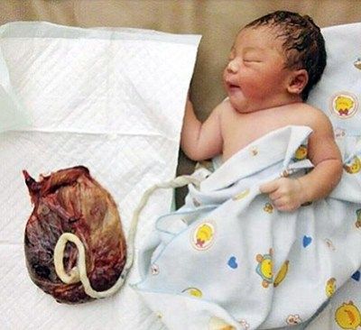 mora-prin-kopsoun-to-emfalio-loro11_