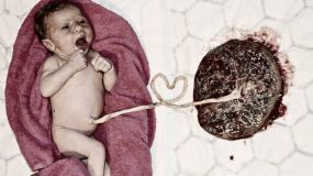 Απίστευτες φωτογραφίες με μωρά συνδεδεμένα με τον εμφάλιο λώρο που θα σας κόψουν την ανάσα!
