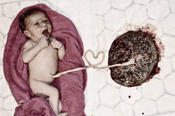 Απίστευτες φωτογραφίες με μωρά συνδεδεμένα με τον εμφάλιο λώρο που θα σας κόψουν την ανάσα!