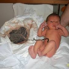 mora-prin-kopsoun-to-emfalio-loro4_