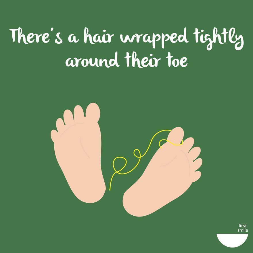 moro-xipnai-mesanichta3_