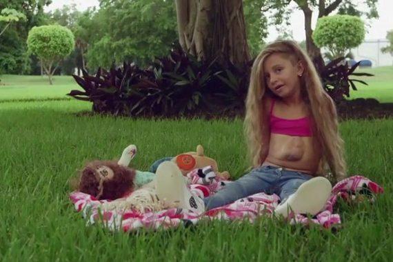 Βίντεο: Συγκλονίζει η θαρραλέα εφτάχρονη που γεννήθηκε με την καρδιά έξω από το στήθος