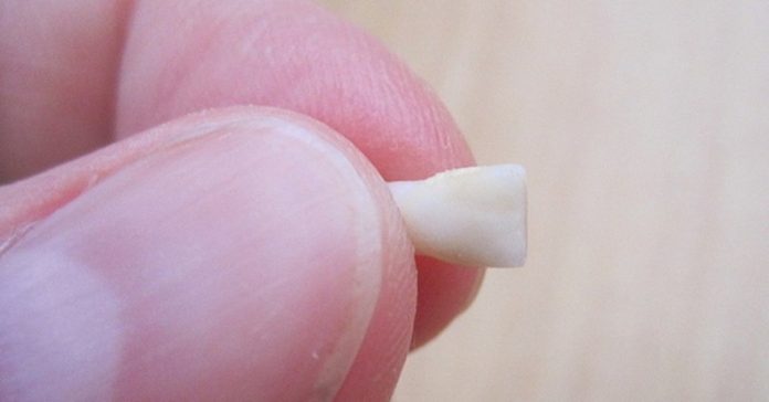Οι Οδοντίατροι Προειδοποιούν: ΜΗΝ Πετάτε τα Δόντια που αλλάζει το Παιδάκι σας. Ο Λόγος; Πολύτιμος!