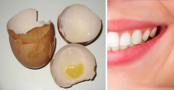 Πώς να απαλλαγείτε από την τερηδόνα των δοντιών χρησιμοποιώντας τσόφλια αυγών;