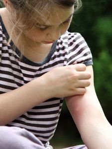 Μήπως αναρωτιέστε τι τσίμπησε το παιδί; Δείτε 12 διαφορετικά τσιμπήματα από έντομα..
