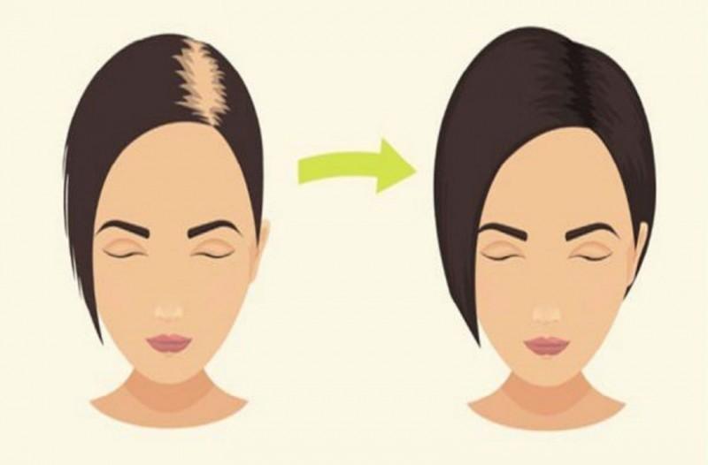 7 λόγοι που χρειάζεστε περισσότερο κολλαγόνο και πως να το αποκτήσετε!