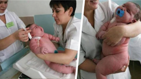 Το μωρό που γεννήθηκε 18 κιλά είναι το μεγαλύτερο σε όλο το κόσμο! Δεν θα πιστεύετε πόσο ζυγίζει η μαμα του!