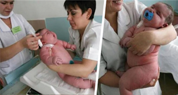 Το μωρό που γεννήθηκε 18 κιλά είναι το μεγαλύτερο σε όλο το κόσμο! Δεν θα πιστεύετε πόσο ζυγίζει η μαμα του!