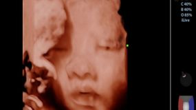 Δείτε τι αισθάνεται το έμβρυο όταν κλαίτε κατά τη διάρκεια της εγκυμοσύνης!