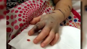 Η ιστορία του 2χρονου κοριτσιού που το δάγκωσε φίδι στο παιδικό σταθμό