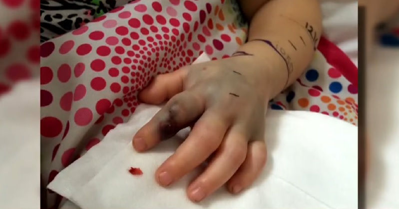 Η ιστορία του 2χρονου κοριτσιού που το δάγκωσε φίδι στο παιδικό σταθμό