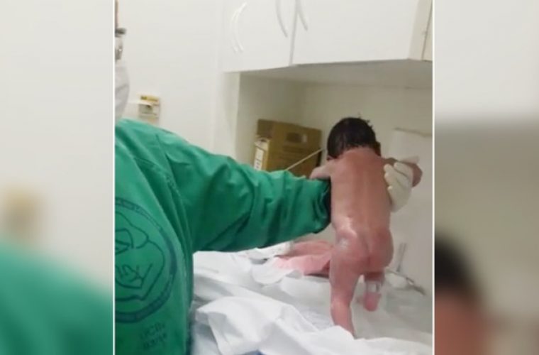 Απίστευτο βίντεο: Νεογέννητο περπατά λίγα μόλις λεπτά μετά τη γέννησή του!