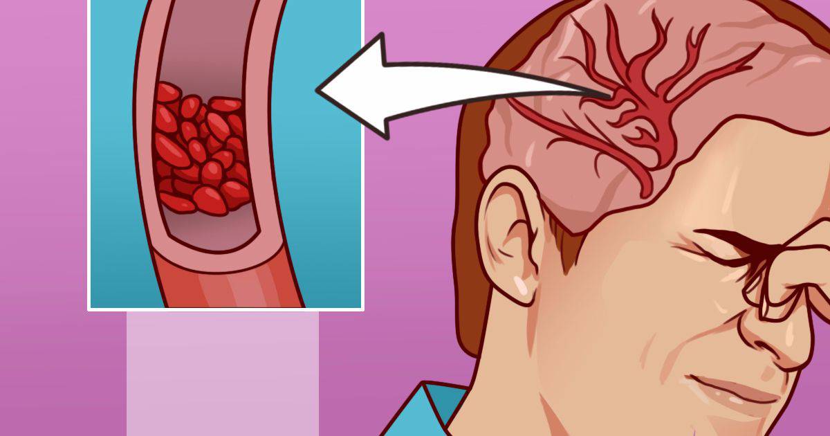 17 τρόφιμα πλούσια σε μαγνήσιο που μπορούν να μειώσουν το κίνδυνο εμφάνισης κατάθλιψης, άγχους, και όχι μόνο..