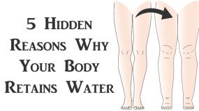 5 λόγοι κατακράτησης υγρών στο σώμα