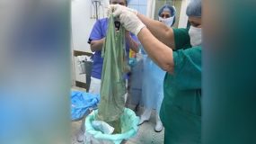 Σοκ: Γιατροί ξεγέννησαν γυναίκα με καισαρική και ξέχασαν το... σεντόνι μέσα στην κοιλιά της! (video+photos)