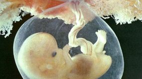 Αιμορραγία κατά τη διάρκεια της εγκυμοσύνης