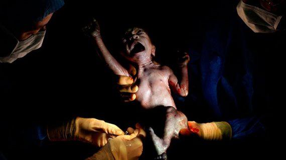 Απίστευτες φωτογραφίες από μωρά, δευτερόλεπτα μετά τη γέννηση τους