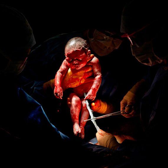 Απίστευτες φωτογραφίες από μωρά, δευτερόλεπτα μετά τη γέννηση τους
