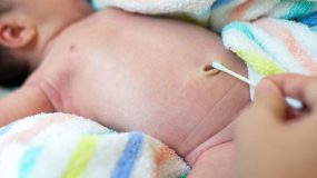 Περιποίηση ομφαλού του νεογέννητου μωρού. Ομφαλίτιδα