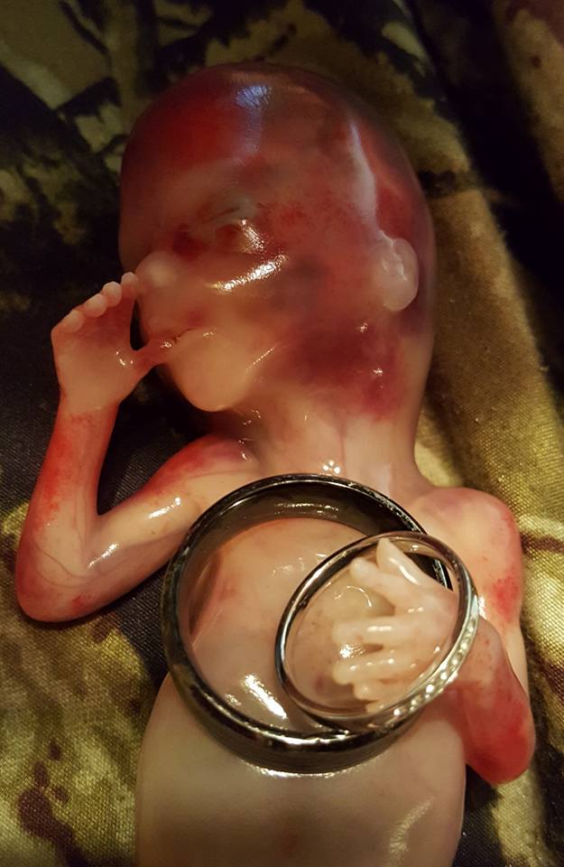 Μητέρα που απέβαλε θέλει όλος ο κόσμος να μάθει ότι η έκτρωση είναι έγκλημα και δημοσιεύει τις φωτογραφίες του εμβρύου της – διαφορετικό