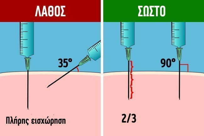 πως να κανετε ενεση μονοι σας3