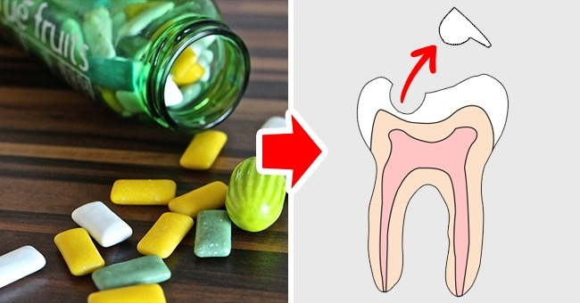 Τα 10 φαγητά και ποτά που βλάπτουν σοβαρά τα δόντια μας