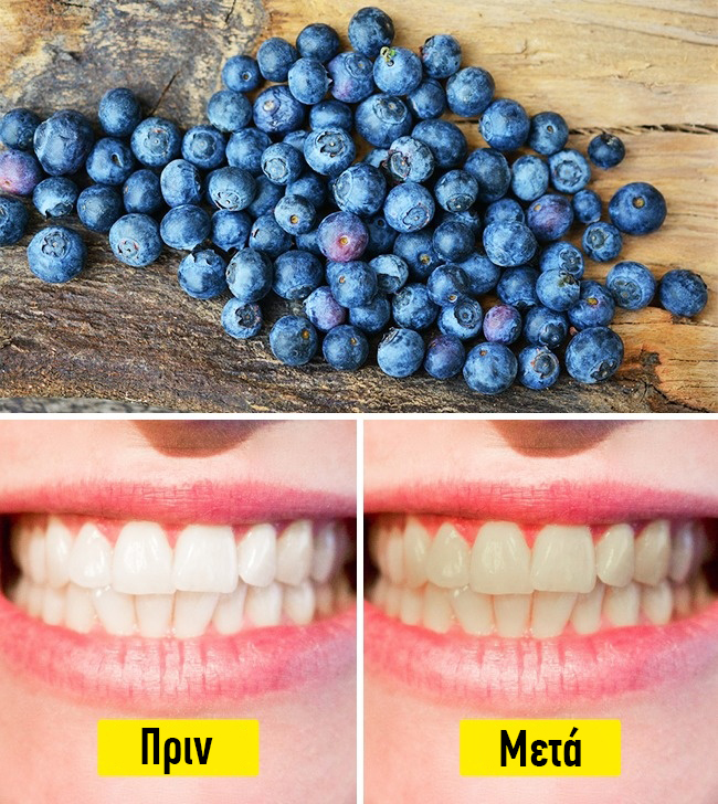 Τα 10 φαγητά και ποτά που βλάπτουν σοβαρά τα δόντια μας
